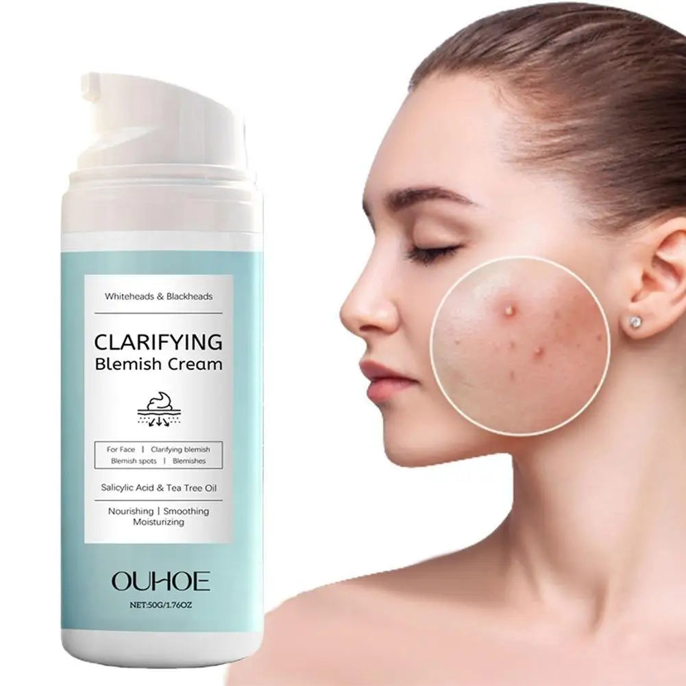 Salicylic Acid Acne Removing Cream Soothing Tea Tree Oil Nourishing Lightweight Non Greasy Moisturizer 50g  Pore Facial Cream